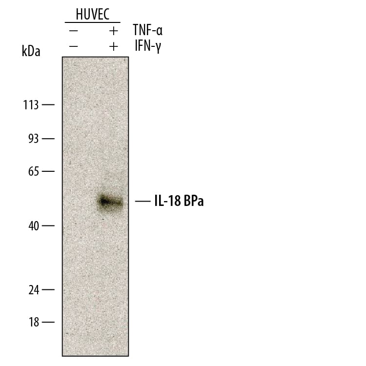 Western Blot IL-18 BPa/IL18BP Antibody [Unconjugated]