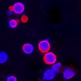 IL-18/IL-1F4 was detected in immersion fixed human PBMC’s using Mouse Anti-Human IL-18/IL-1F4 Monoclonal Antibody (Catalog # MAB2548) at 25 µg/mL for 3 hours at room temperature. Cells were stained using the NorthernLights™ 557-conjugated Anti-Mouse IgG Secondary Antibody (red; NL007) and counterstained with DAPI (blue). Specific staining was localized to cytoplasm. View our protocol for Fluorescent ICC Staining of Non-adherent Cells.