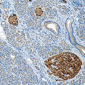 IL-18/IL-1F4 was detected in immersion fixed paraffin-embedded sections of human pancreas using Mouse Anti-Human IL-18/IL-1F4 Monoclonal Antibody (Catalog # MAB91245) at 5 µg/mL for 1 hour at room temperature followed by incubation with the Anti-Mouse IgG VisUCyte™ HRP Polymer Antibody (Catalog # VC001). Before incubation with the primary antibody, tissue was subjected to heat-induced epitope retrieval using Antigen Retrieval Reagent-Basic (Catalog # CTS013). Tissue was stained using DAB (brown) and counterstained with hematoxylin (blue). Specific staining was localized to cytoplasm in islet cells. View our protocol for IHC Staining with VisUCyte HRP Polymer Detection Reagents.