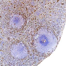 IL-18/IL-1F4 was detected in immersion fixed paraffin-embedded sections of human spleen using Mouse Anti-Human IL-18/IL-1F4 Monoclonal Antibody (Catalog # MAB91245) at 15 µg/mL for 1 hour at room temperature followed by incubation with the Anti-Mouse IgG VisUCyte™ HRP Polymer Antibody (Catalog # VC001). Before incubation with the primary antibody, tissue was subjected to heat-induced epitope retrieval using Antigen Retrieval Reagent-Basic (Catalog # CTS013). Tissue was stained using DAB (brown) and counterstained with hematoxylin (blue). Specific staining was localized to T cells. View our protocol for IHC Staining with VisUCyte HRP Polymer Detection Reagents.