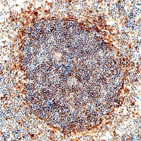 Immunohistochemistry IL-1 RII Antibody [Unconjugated]