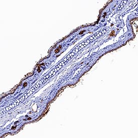 Immunohistochemistry IL-1 RI Antibody [Unconjugated]
