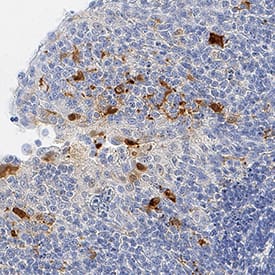 IL-1 beta /IL-1F2 was detected in immersion fixed paraffin-embedded sections of human tonsil using Goat Anti-Human IL-1 beta /IL-1F2 Antigen Affinity-purified Polyclonal Antibody (Catalog # AF-201-NA) at 1 µg/mL for 1 hour at room temperature followed by incubation with the Anti-Goat IgG VisUCyte™ HRP Polymer Antibody (Catalog # VC004). Tissue was stained using DAB (brown) and counterstained with hematoxylin (blue). Specific staining was localized to cytoplasm in lymphocytes. View our protocol for IHC Staining with VisUCyte HRP Polymer Detection Reagents.