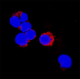 <b>Biological Strategies Validation. </b>IL-1 beta /IL-1F2 was detected in immersion fixed MCF-7 human breast cancer cell line using Goat Anti-Mouse IL-1 beta /IL-1F2 Antigen Affinity-purified Polyclonal Antibody (Catalog # AF-401-NA) at 8 µg/mL for 3 hours at room temperature. Cells were stained using the NorthernLights™ 557-conjugated Anti-Goat IgG Secondary Antibody (red; NL001) and counterstained with DAPI (blue). Specific staining was localized to cytoplasm. View our protocol for Fluorescent ICC Staining of Cells on Coverslips.