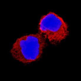 IL-1 beta /IL-1F2 was detected in immersion fixed human peripheral blood mononuclear cells (PBMCs) using Mouse Anti-Human IL-1 beta /IL-1F2 Monoclonal Antibody (Catalog # MAB601) at 8 µg/mL for 3 hours at room temperature. Cells were stained using the NorthernLights™ 557-conjugated Anti-Mouse IgG Secondary Antibody (red; Catalog # NL007) and counterstained with DAPI (blue). Specific staining was localized to cytoplasm. View our protocol for Fluorescent ICC Staining of Non-adherent Cells.