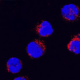 IL-1 beta /IL-1F2 was detected in immersion fixed human peripheral blood mononuclear cells using Mouse Anti-Human IL-1 beta /IL-1F2 Propeptide Monoclonal Antibody (Catalog # MAB6964) at 15 µg/mL for 3 hours at room temperature. Cells were stained using the NorthernLights™ 557-conjugated Anti-Mouse IgG Secondary Antibody (red; Catalog # NL007) and counterstained with DAPI(blue). Specific staining was localized to cytoplasmic. View our protocol for Fluorescent ICC Staining of Non-adherent Cells.