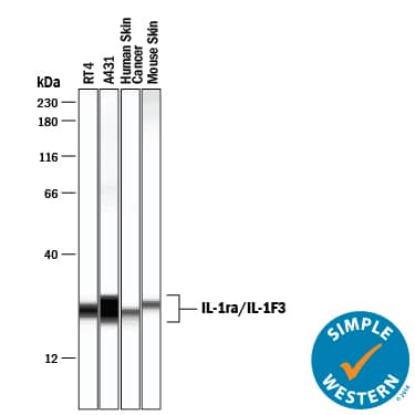 Simple Western lane view shows lysates of RT-4 human bladder carcinoma cell line, A431 human epithelial carcinoma cell line, human skin cancer tissue, and mouse skin cancer tissue, loaded at 0.2 mg/mL. A specific band was detected for IL-1ra/IL-1F3 at approximately 24-26 kDa (as indicated) using 20 µg/mL of Goat Anti-Human IL-1ra/IL-1F3 Antigen Affinity-purified Polyclonal Antibody (Catalog # AF-280-NA) followed by 1:50 dilution of HRP-conjugated Anti-Goat IgG Secondary Antibody (Catalog # HAF109). This experiment was conducted under reducing conditions and using the 12-230 kDa separation system.