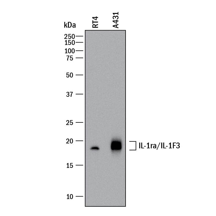 Western blot shows lysates of RT-4 human bladder carcinoma cell line and A431 human epithelial carcinoma cell line. PVDF membrane was probed with 0.5 µg/mL of Goat Anti-Human IL-1ra/IL-1F3 Antigen Affinity-purified Polyclonal Antibody (Catalog # AF-280-NA) followed by HRP-conjugated Anti-Goat IgG Secondary Antibody (Catalog # HAF017). A specific band was detected for IL-1ra/IL-1F3 at approximately 18-20 kDa (as indicated). This experiment was conducted under reducing conditions and using Immunoblot Buffer Group 1.