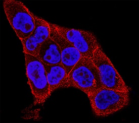 IL-1ra/IL-1F3 was detected in immersion fixed A431 human epithelial carcinoma cell line using Rat Anti-Mouse IL-1ra/IL-1F3 Monoclonal Antibody (Catalog # MAB4802) at 3 µg/mL for 3 hours at room temperature. Cells were stained using the NorthernLights™ 557-conjugated Anti-Rat IgG Secondary Antibody (red; Catalog # NL013) and counterstained with DAPI (blue). Specific staining was localized to cytoplasm. View our protocol for Fluorescent ICC Staining of Cells on Coverslips.
