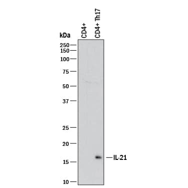 Western blot shows lysates of human CD4+ T cells (negative control) and human CD4+ Th17 cells. PVDF membrane was probed with 1 µg/mL of Goat Anti-Human IL-21 Antigen Affinity-purified Polyclonal Antibody (Catalog # AF15001) followed by HRP-conjugated Anti-Goat IgG Secondary Antibody (Catalog # HAF017). A specific band was detected for IL-21 at approximately 18 kDa (as indicated). This experiment was conducted under reducing conditions and using Immunoblot Buffer Group 1.