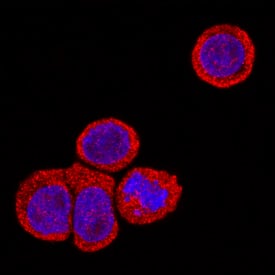 Immunocytochemistry IL-22R alpha 1 Antibody (305405) [Unconjugated]