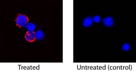 IL-2 was detected in immersion fixed feline peripheral blood mononuclear cells (PBMCs) stimulated with PMA and calcium ionomycin using Goat Anti-Feline IL-2 Antigen Affinity-purified Polyclonal Antibody (Catalog # AF1890) at 15 µg/mL for 3 hours at room temperature. Cells were stained using the NorthernLights™ 557-conjugated Anti-Goat IgG Secondary Antibody (red; Catalog # NL001) and counterstained with DAPI (blue). Specific staining was localized to cytoplasm. View our protocol for Fluorescent ICC Staining of Non-adherent Cells.