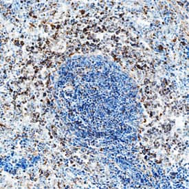 IL-2 was detected in immersion fixed frozen sections of rat spleen using Goat Anti-Human/Rat IL-2 Antigen Affinity-purified Polyclonal Antibody (Catalog # AF-502-NA) at 5 µg/mL overnight at 4 °C. Tissue was stained using the Anti-Goat HRP-DAB Cell & Tissue Staining Kit (brown; CTS008) and counterstained with hematoxylin (blue). Specific staining was localized to cytoplasm in lymphocytes. View our protocol for Chromogenic IHC Staining of Frozen Tissue Sections.