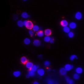 IL-2 was detected in immersion fixed human peripheral blood mononuclear cells (PBMCs) treated with calcium ionomycin and PMA using Rabbit Anti-Human IL-2 Monoclonal Antibody (Catalog # MAB10356) at 8 µg/mL for 3 hours at room temperature. Cells were stained using the NorthernLights™ 557-conjugated Anti-Rabbit IgG Secondary Antibody (red; Catalog # NL004) and counterstained with DAPI (blue). Specific staining was localized to cytoplasm. View our protocol for Fluorescent ICC Staining of Non-adherent Cells.
