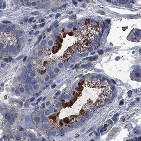 IL-2 was detected in immersion fixed paraffin-embedded sections of human stomach using Mouse Anti-Human IL-2 Monoclonal Antibody (Catalog # MAB2022) at 5 µg/mL for 1 hour at room temperature followed by incubation with the Anti-Mouse IgG VisUCyte™ HRP Polymer Antibody (Catalog # VC001). Before incubation with the primary antibody, tissue was subjected to heat-induced epitope retrieval using Antigen Retrieval Reagent-Basic (Catalog # CTS013). Tissue was stained using DAB (brown) and counterstained with hematoxylin (blue). Specific staining was localized to intestinal glands. View our protocol for IHC Staining with VisUCyte HRP Polymer Detection Reagents.