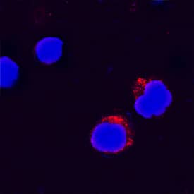 Immunocytochemistry IL-31 Antibody [Unconjugated]