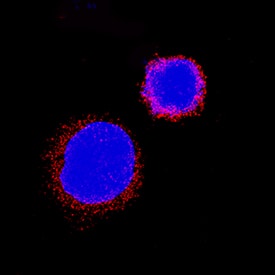 Immunocytochemistry IL-31RA Antibody [Unconjugated]