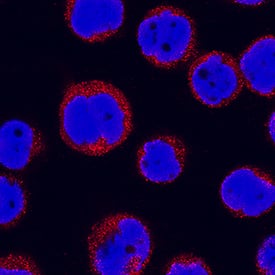 Immunocytochemistry IL-31RA Antibody [Unconjugated]