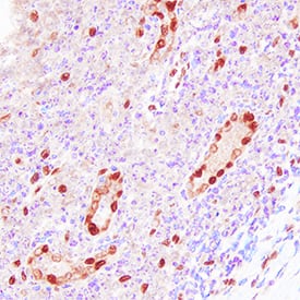 IL-33 was detected in immersion fixed paraffin-embedded sections of human tonsil using Goat Anti-Human IL-33 Antigen Affinity-purified Polyclonal Antibody (Catalog # AF3625) at 10 µg/mL overnight at 4 °C. Tissue was stained using the Anti-Goat HRP-DAB Cell & Tissue Staining Kit (brown; Catalog # CTS008) and counterstained with hematoxylin (blue). Specific staining was localized to nuclei. View our protocol for Chromogenic IHC Staining of Paraffin-embedded Tissue Sections.