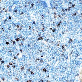 IL-33 was detected in immersion fixed frozen sections of mouse spleen using Goat Anti-Mouse IL-33 Antigen Affinity-purified Polyclonal Antibody (Catalog # AF3626) at 5 µg/mL overnight at 4 °C. Tissue was stained using the Anti-Goat HRP-DAB Cell & Tissue Staining Kit (brown; Catalog # CTS008) and counterstained with hematoxylin (blue). Specific staining was localized to cytoplasm in lymphocytes. View our protocol for Chromogenic IHC Staining of Frozen Tissue Sections.