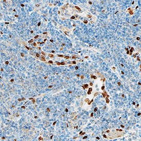 IL-33 was detected in immersion fixed paraffin-embedded sections of human tonsil using Rabbit Anti-Human IL-33 Monoclonal Antibody (Catalog # MAB36252) at 15 µg/mL overnight at 4 °C. Tissue was stained using the Anti-Rabbit HRP-DAB Cell & Tissue Staining Kit (brown; Catalog # CTS005) and counterstained with hematoxylin (blue). Specific staining was localized to nuclei in high endothelial venules. View our protocol for Chromogenic IHC Staining of Paraffin-embedded Tissue Sections.