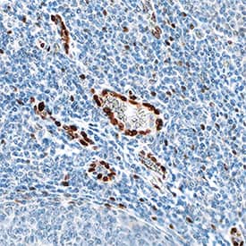 IL-33 was detected in immersion fixed paraffin-embedded sections of human tonsil using Goat Anti-Human IL-33 Monoclonal Antibody (Catalog # MAB36253) at 0.1 µg/mL overnight at 4 °C. Tissue was stained using the Anti-Goat HRP-DAB Cell & Tissue Staining Kit (brown; CTS008) and counterstained with hematoxylin (blue). Specific staining was localized to nuclei in epithelial cells. View our protocol for Chromogenic IHC Staining of Paraffin-embedded Tissue Sections.