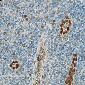 IL-33 was detected in immersion fixed paraffin-embedded sections of human tonsil using Recombinant Goat Anti-Human IL-33 Monoclonal Antibody (Catalog # MAB36254) at 0.3 µg/mL overnight at 4 °C. Tissue was stained using the Anti-Goat HRP-DAB Cell & Tissue Staining Kit (brown; Catalog # CTS008) and counterstained with hematoxylin (blue). Specific staining was localized to nuclei. View our protocol for Chromogenic IHC Staining of Paraffin-embedded Tissue Sections.