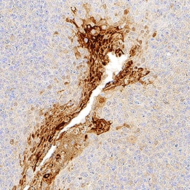 IL-36a/IL-1F6 was detected in perfusion fixed paraffin-embedded sections of human tonsil using Goat Anti-Human IL-36a/IL-1F6 Antigen Affinity-purified Polyclonal Antibody (Catalog # AF1078) at 1 µg/mL for 1 hour at room temperature followed by incubation with the Anti-Goat IgG VisUCyte™ HRP Polymer Antibody (Catalog # VC004). Tissue was stained using DAB (brown) and counterstained with hematoxylin (blue). Specific staining was localized to cytoplasm in lymphocytes. View our protocol for IHC Staining with VisUCyte HRP Polymer Detection Reagents.
