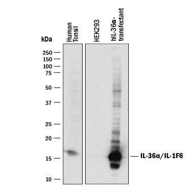 Western blot shows lysates of human tonsil tissue, HEK293 human embryonic kidney cell line either mock transfected or transfected with human IL-36a/IL-1F6. PVDF membrane was probed with 1 µg/mL of Goat Anti-Human IL-36a/IL-1F6 Antigen Affinity-purified Polyclonal Antibody (Catalog # AF1078) followed by HRP-conjugated Anti-Goat IgG Secondary Antibody (Catalog # HAF017). A specific band was detected for IL-36a/IL-1F6 at approximately 16 kDa (as indicated). This experiment was conducted under reducing conditions and using Immunoblot Buffer Group 1.