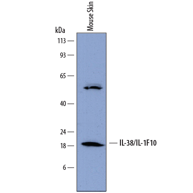 Western blot shows lysates of mouse skin tissue. PVDF membrane was probed with 2 µg/mL of Rat Anti-Mouse IL-38/IL-1F10 Monoclonal Antibody (Catalog # MAB7774) followed by HRP-conjugated Anti-Rat IgG Secondary Antibody (Catalog # HAF005). A specific band was detected for IL-38/IL-1F10 at approximately 18 kDa (as indicated). This experiment was conducted under reducing conditions and using Immunoblot Buffer Group 1.