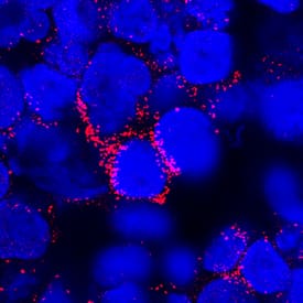 Immunocytochemistry IL-3 Antibody (4806) [Unconjugated]