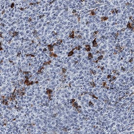 IL-4I1 was detected in immersion fixed paraffin-embedded sections of human B cell lymphoma using Rat Anti-Human IL-4I1 Monoclonal Antibody (Catalog # MAB5684) at 5 µg/mL for 1 hour at room temperature followed by incubation with the Anti-Rat IgG VisUCyte™ HRP Polymer Antibody (Catalog # VC005). Before incubation with the primary antibody, tissue was subjected to heat-induced epitope retrieval using Antigen Retrieval Reagent-Basic (Catalog # CTS013). Tissue was stained using DAB (brown) and counterstained with hematoxylin (blue). Specific staining was localized to cytoplasm in lymphocytes. View our protocol for IHC Staining with VisUCyte HRP Polymer Detection Reagents.