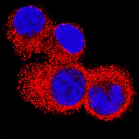 IL-4 Ra was detected in immersion fixed HDLM-2 human Hodgkin's lymphoma cell line using Mouse Anti-Human IL-4 Ra Monoclonal Antibody (Catalog # MAB230) at 8 µg/mL for 3 hours at room temperature. Cells were stained using the NorthernLights™ 557-conjugated Anti-Mouse IgG Secondary Antibody (red; Catalog # NL007) and counterstained with DAPI (blue). Specific staining was localized to cytoplasm. View our protocol for Fluorescent ICC Staining of Non-adherent Cells.