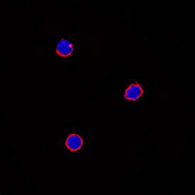 IL-6 was detected in immersion fixed equine peripheral blood mononuclear cells (PBMCs) using Goat Anti-Equine IL-6 Antigen Affinity-purified Polyclonal Antibody (Catalog # AF1886) at 10 µg/mL for 3 hours at room temperature. Cells were stained using the NorthernLights™ 557-conjugated Anti-Goat IgG Secondary Antibody (red; Catalog # NL001) and counterstained with DAPI (blue). Specific staining was localized to the cell surface. View our protocol for Fluorescent ICC Staining of Non-adherent Cells.