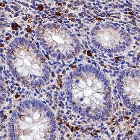 IL-6 was detected in immersion fixed paraffin-embedded sections of human appendix using Mouse Anti-Human IL-6 Monoclonal Antibody (Catalog # MAB2061) at 1.7 µg/mL for 1 hour at room temperature followed by incubation with the Anti-Mouse IgG VisUCyte™ HRP Polymer Antibody (VC001). Before incubation with the primary antibody, tissue was subjected to heat-induced epitope retrieval using Antigen Retrieval Reagent-Basic (CTS013). Tissue was stained using DAB (brown) and counterstained with hematoxylin (blue). Specific staining was localized to cytoplasm in lymphocytes. View our protocol for IHC Staining with VisUCyte HRP Polymer Detection Reagents.