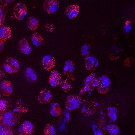 IL-6 was detected in immersion fixed frozen sections of hyperplastic human skin using Mouse Anti-Human/Primate IL-6 Monoclonal Antibody (Catalog # MAB206) at 8 µg/mL overnight at 4 °C. Tissue was stained using the NorthernLights™ 557-conjugated Anti-Mouse IgG Secondary Antibody (red; Catalog # NL007) and counterstained with DAPI (blue). Specific staining was localized to cytoplasm. View our protocol for Fluorescent IHC Staining of Frozen Tissue Sections.