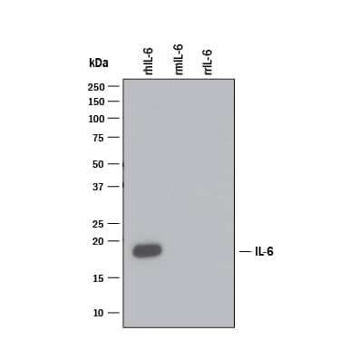 Western blot shows 25 ng of Recombinant Human IL-6 (Catalog # 206-IL), Recombinant Mouse IL-6 (Catalog # 406-ML) and Recombinant Rat IL-6 (Catalog # 506-RL). PVDF Membrane was probed with 1 µg/mL of Mouse Anti-Human/ Primate IL-6 Monoclonal Antibody (Catalog # MAB206) followed by HRP-conjugated Anti-Mouse IgG Secondary Antibody (Catalog # HAF007). A specific band was detected for IL-6 at approximately 18 kDa (as indicated). This experiment was conducted under reducing conditions and using Immunoblot Buffer Group 3.