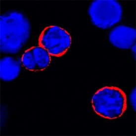 IL-6R alpha was detected in immersion fixed mouse splenocytes using Rat Anti-Mouse IL-6R alpha Monoclonal Antibody (Catalog # MAB18301) at 15 µg/mL for 3 hours at room temperature. Cells were stained using the NorthernLights™ 557-conjugated Anti-Rat IgG Secondary Antibody (red; Catalog # NL013) and counterstained with DAPI (blue). Specific staining was localized to cytoplasm. View our protocol for Fluorescent ICC Staining of Non-adherent Cells.