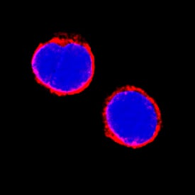 IL-6R alpha was detected in immersion fixed human peripheral blood mononuclear cells (PBMCs) using Mouse Anti-Human IL-6R alpha Monoclonal Antibody (Catalog # MAB2271) at 8 µg/mL for 3 hours at room temperature. Cells were stained using the NorthernLights™ 557-conjugated Anti-Mouse IgG Secondary Antibody (red; Catalog # NL007) and counterstained with DAPI (blue). Specific staining was localized to cell surfaces. View our protocol for Fluorescent ICC Staining of Non-adherent Cells.