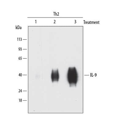 Western blot shows lysates of human Th2 cells treated with (1) anti-CD3 and anti-CD28, (2) anti-CD3, anti-CD28, Recombinant Human IL-2 (Catalog # 202-IL), Recombinant Human IL-4 (Catalog # 204-IL), and Mouse Anti-Human IFN-gamma Monoclonal Antibody (Catalog # MAB285) or (3) anti-CD3, anti-CD28, Recombinant Human IL-2 (Catalog # 202-IL), Recombinant Human IL-4 (Catalog # 204-IL), Mouse Anti-Human IFN-gamma Monoclonal Antibody (Catalog # MAB285), and Recombinant Human TGF-beta 1 (Catalog # 240-B). PVDF membrane was probed with a 0.1 µg/mL of Rabbit Anti-Human IL-9 Monoclonal Antibody (Catalog # MAB2091) followed by HRP-conjugated Anti-Rabbit IgG Secondary Antibody (Catalog # HAF008). A specific band was detected for IL-9 at approximately 35-40 kDa (as indicated). This experiment was conducted under reducing conditions and using Immunoblot Buffer Group 1.