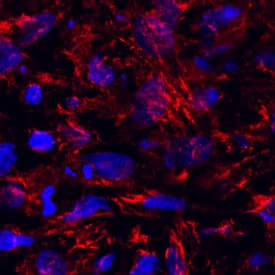 Inositol Monophosphatase 3/IMPAD1 was detected in immersion fixed mouse mesenchymal stem cells differentiated into chondrocytes using Sheep Anti-Mouse/Rat Inositol Monophosphatase 3/IMPAD1 Antigen Affinity-purified Polyclonal Antibody (Catalog # AF7028) at 10 µg/mL for 3 hours at room temperature. Cells were stained using the NorthernLights™ 557-conjugated Anti-Sheep IgG Secondary Antibody (red; Catalog # NL010) and counterstained with DAPI (blue). Specific staining was localized to cytoplasm. View our protocol for Fluorescent ICC Staining of Cells on Coverslips.