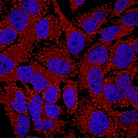 Immunocytochemistry IMPDH1 Antibody [Unconjugated]