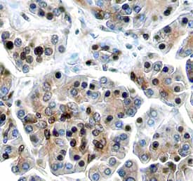 Immunohistochemistry ING1 Antibody (585922)