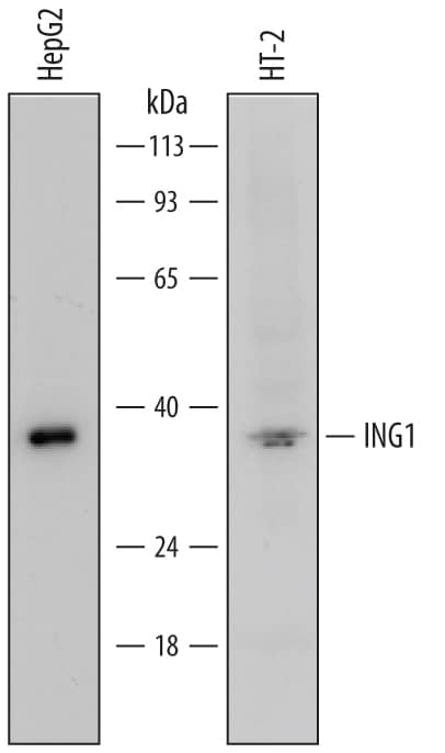 Western Blot ING1 Antibody (585915)