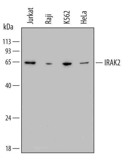 Western Blot IRAK2 Antibody (600848)
