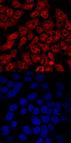 Immunocytochemistry IRF2BP1 Antibody