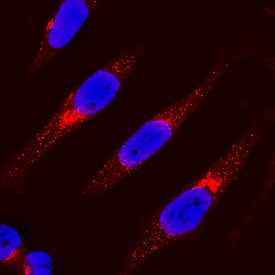 IRF3 was detected in immersion fixed HeLa human cervical epithelial carcinoma cell line using Goat Anti-Human IRF3 Antigen Affinity-purified Polyclonal Antibody (Catalog # AF4019) at 15 µg/mL for 3 hours at room temperature. Cells were stained using the NorthernLights™ 557-conjugated Anti-Goat IgG Secondary Antibody (red; Catalog # NL001) and counterstained with DAPI (blue). Specific staining was localized to cytoplasm. View our protocol for Fluorescent ICC Staining of Cells on Coverslips.