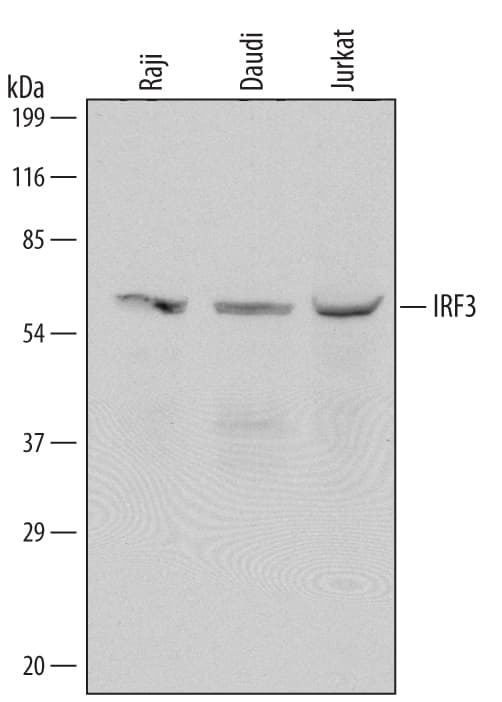 Western blot shows lysates of Raji human Burkitt's lymphoma cell line, Daudi human Burkitt's lymphoma cell line, and Jurkat human acute T cell leukemia cell line. PVDF Membrane was probed with 1 µg/mL of Mouse Anti-Human IRF3 Monoclonal Antibody (Catalog # MAB4019) followed by HRP-conjugated Anti-Mouse IgG Secondary Antibody (Catalog # HAF007). A specific band was detected for IRF3 at approximately 60 kDa (as indicated). This experiment was conducted under reducing conditions and using Immunoblot Buffer Group 1.
