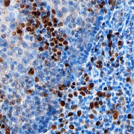 IRF4 was detected in immersion fixed paraffin-embedded sections of human tonsil using Sheep Anti-Human IRF4 Antigen Affinity-purified Polyclonal Antibody (Catalog # AF5525) at 3 µg/mL overnight at 4 °C. Before incubation with the primary antibody, tissue was subjected to heat-induced epitope retrieval using Antigen Retrieval Reagent-Basic (Catalog # CTS013). Tissue was stained using the Anti-Sheep HRP-DAB Cell & Tissue Staining Kit (brown; Catalog # CTS019) and counterstained with hematoxylin (blue). Specific staining was localized to cytoplasm of lymphocytes. View our protocol for Chromogenic IHC Staining of Paraffin-embedded Tissue Sections.