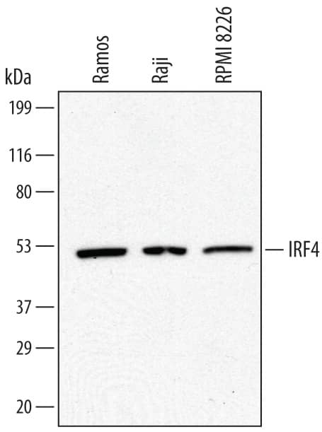 Western blot shows lysates of Ramos human Burkitt's lymphoma cell line, Raji human Burkitt's lymphoma cell line, and RPMI 8226 human multiple myeloma cell line. PVDF membrane was probed with 0.5 µg/mL of Sheep Anti-Human IRF4 Antigen Affinity-purified Polyclonal Antibody (Catalog # AF5525) followed by HRP-conjugated Anti-Sheep IgG Secondary Antibody (Catalog # HAF016). A specific band was detected for IRF4 at approximately 53 kDa (as indicated). This experiment was conducted under reducing conditions and using Immunoblot Buffer Group 1.